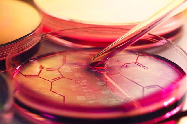 Stemcell therapy Stemcell therapy
