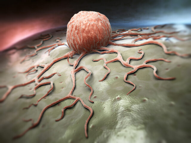 cancercell