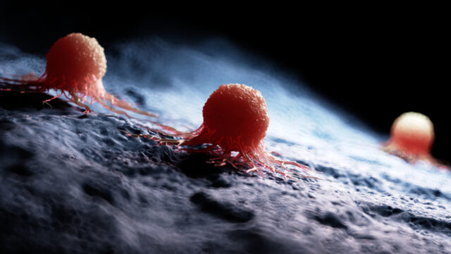tumorcell