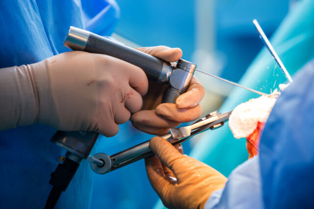 Orthopedic_surgery