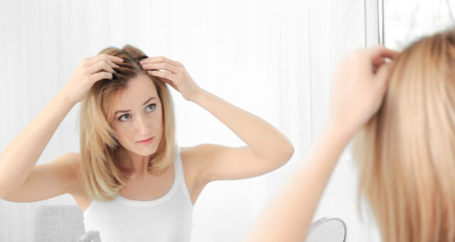 hairloss