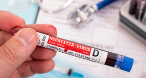 Hepatit D Test