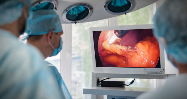BiBBEndoscopy BiBBInstruments Endoscopic Ultrasound