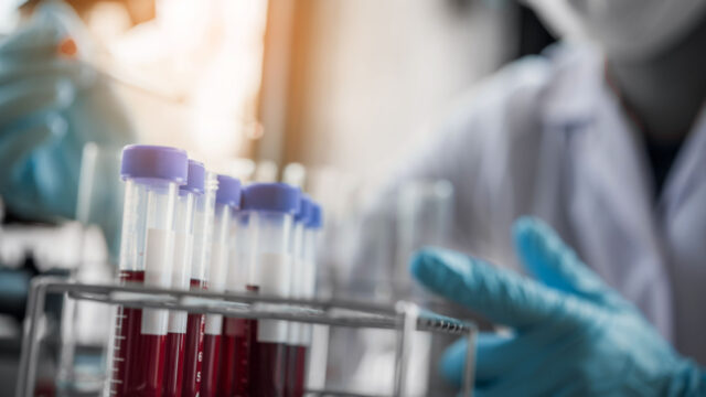bloodlab Artikelbild Aptahem