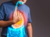 Aqilion Eosinophilic Esophagitis 
